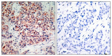 PTEN Antibody
