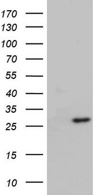 PTEN Antibody