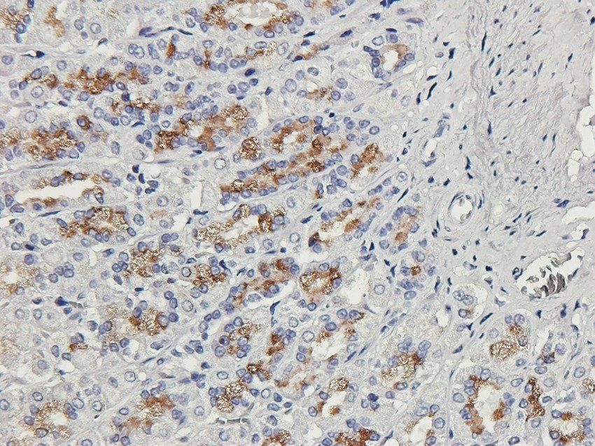 PTEN Rabbit Polyclonal Antibody