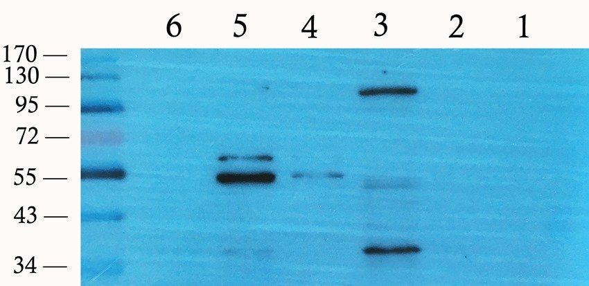 PTEN Rabbit Polyclonal Antibody