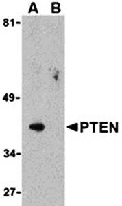 PTEN Antibody