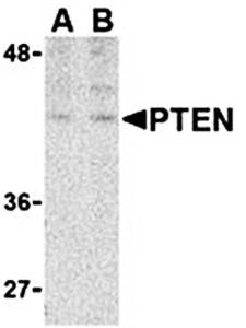 PTEN Antibody