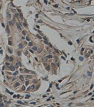 PTEN Rabbit Polyclonal Antibody