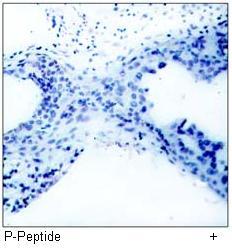 PTEN (Phospho-Ser380/Thr382/Thr383) Antibody