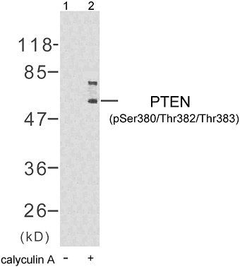 PTEN (Phospho-Ser380/Thr382/Thr383) Antibody