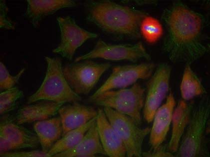 PTEN (Phospho-Ser380/Thr382/Thr383) Antibody