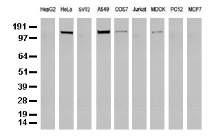 PTF1A Antibody
