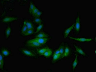 PTGDS Antibody