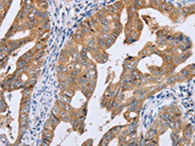 PTGER2 Antibody