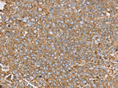PTGER2 Antibody