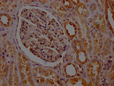 PTGER2 Recombinant Monoclonal Antibody