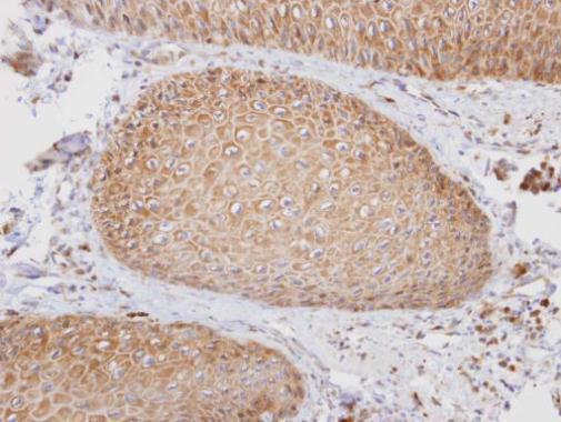 PTGFRN antibody [C3], C-term