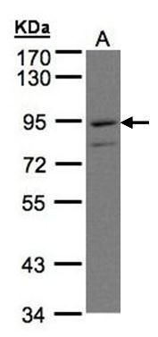 PTGFRN antibody