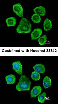 prostaglandin F2 receptor negative regulator antibody