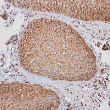 prostaglandin F2 receptor negative regulator antibody
