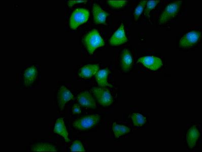 PTGR2 antibody