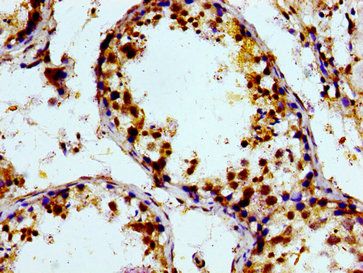 PTGR2 Antibody