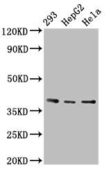 PTGR2 antibody