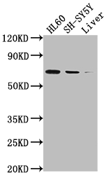 PTGS1 Recombinant Monoclonal Antibody