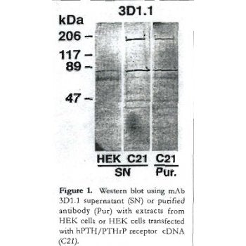 PTHLH Monoclonal Antibody [3979]