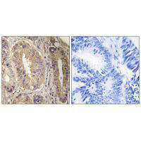 PTK2 (Ab-843) Antibody
