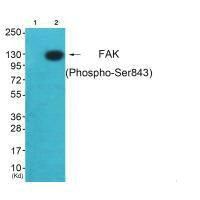 PTK2 (Ab-843) Antibody