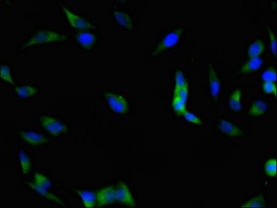 PTK2 Antibody