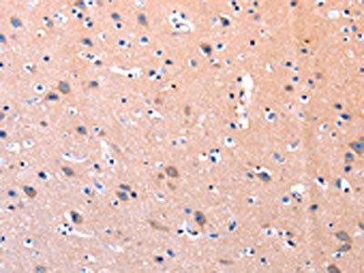 PTK2 Antibody