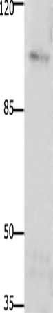 PTK2 Antibody