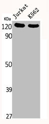 PTK2 Antibody