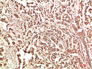 PTK2 Antibody