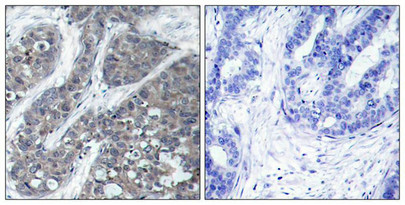 PTK2B (Ab-402) Antibody