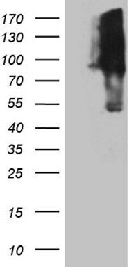 TWF1 Antibody
