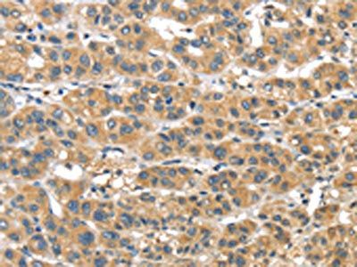PTMA Antibody