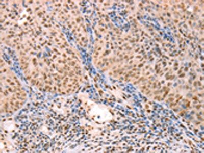 PTMA Antibody