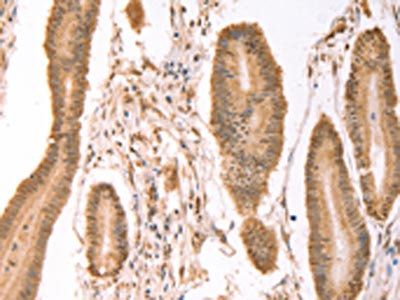PTMA Antibody