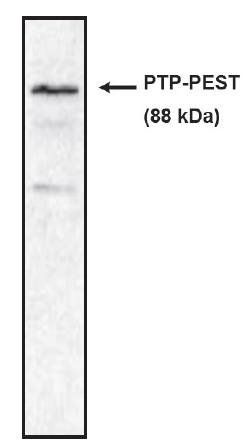 Mouse Human PTP PEST Antibody