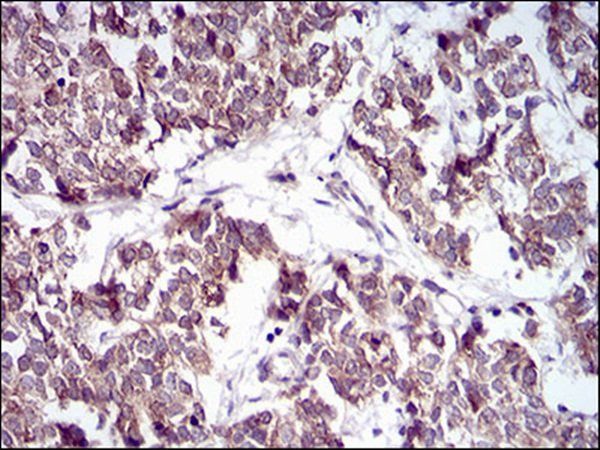 PTPN1 Antibody