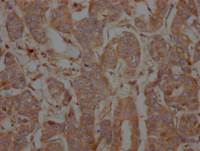 PTPN1 Recombinant Monoclonal Antibody