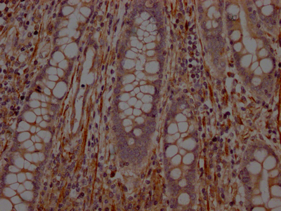PTPN1 Recombinant Monoclonal Antibody