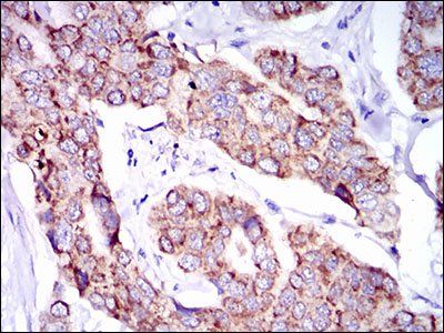 PTPN11 Antibody