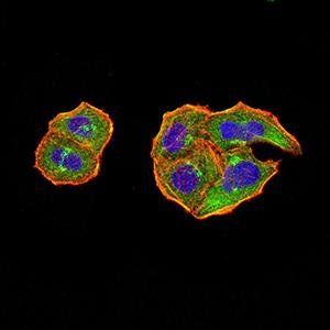 PTPN14 Antibody