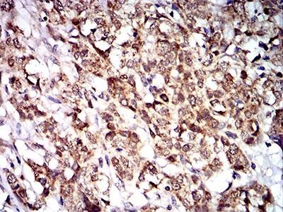 PTPN14 Antibody