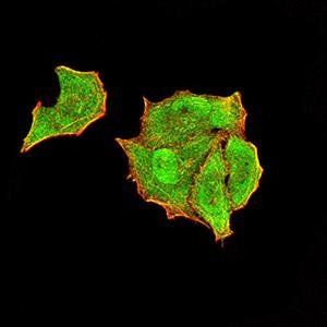 PTPN14 Antibody