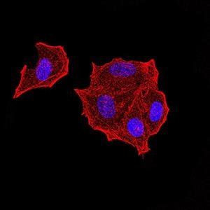 PTPN14 Antibody