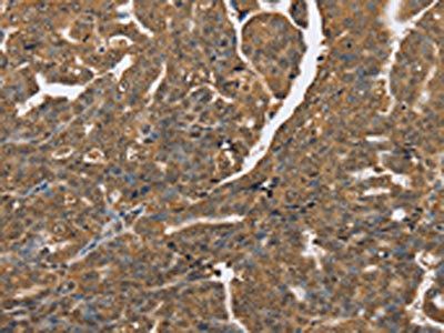 PTPN20A; Antibody