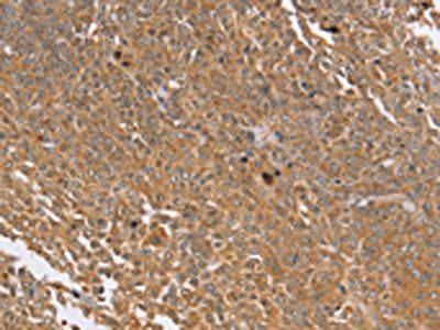 PTPN20A; Antibody