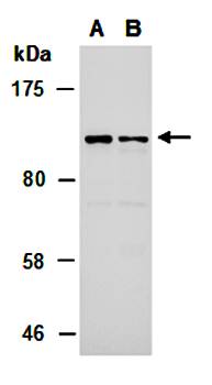 PTPN22 (N) Antibody, Rabbit Polyclonal