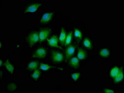PTPN3 Antibody