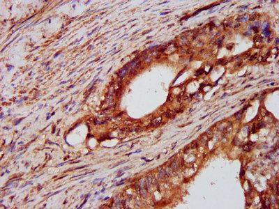 PTPN3 Antibody